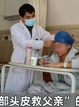 22岁女子为救父亲取下全部头皮