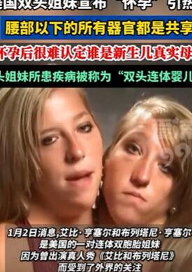 美国双头姐妹宣布怀孕,一个身子两个头共用一个子宫引热议
