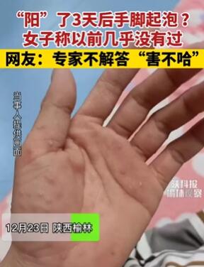 女子阳了3天后手脚起泡特别痒