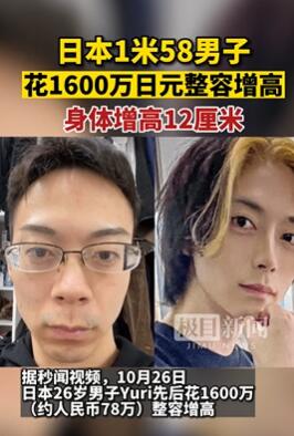 日本1.58米男子花1600万日元整容增高